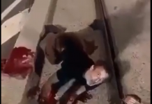 (VIDEO) Francozu, ki je želel zaščititi svoj avto pred zažigom, polomili kosti in odrezali roko