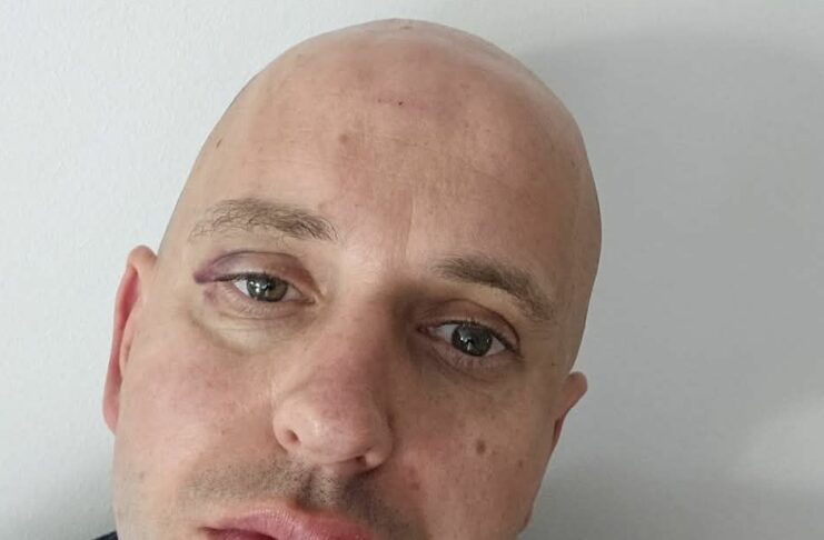 Romi pretepli župana Ribnice